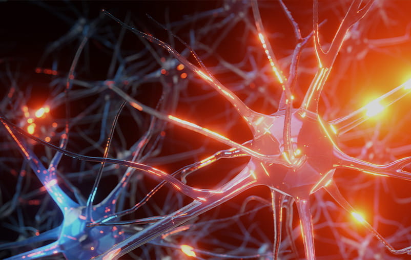 Illustration of agitated nerve endings, indicative of MS.